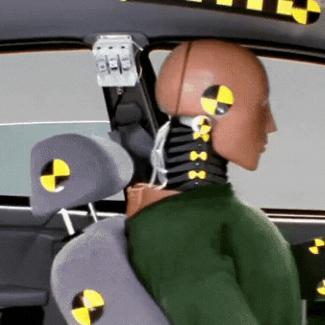 Neurofeedback for TBI’s