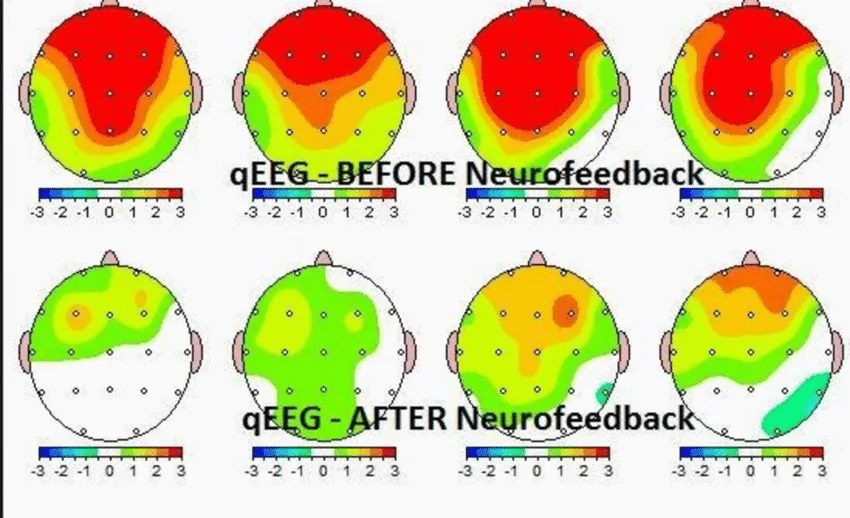 EVIDENCE-BASED TREATMENT