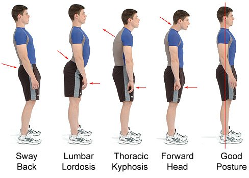 Three Signs That You Have Muscle Imbalance In Your Body